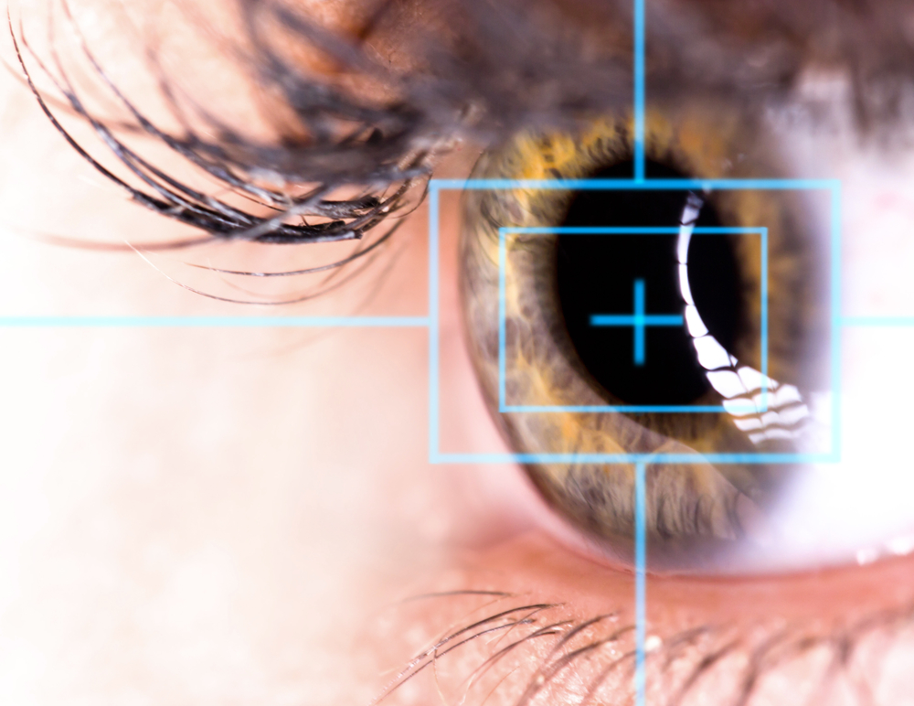 Operácia očí laserom. Foto: Shutterstock
