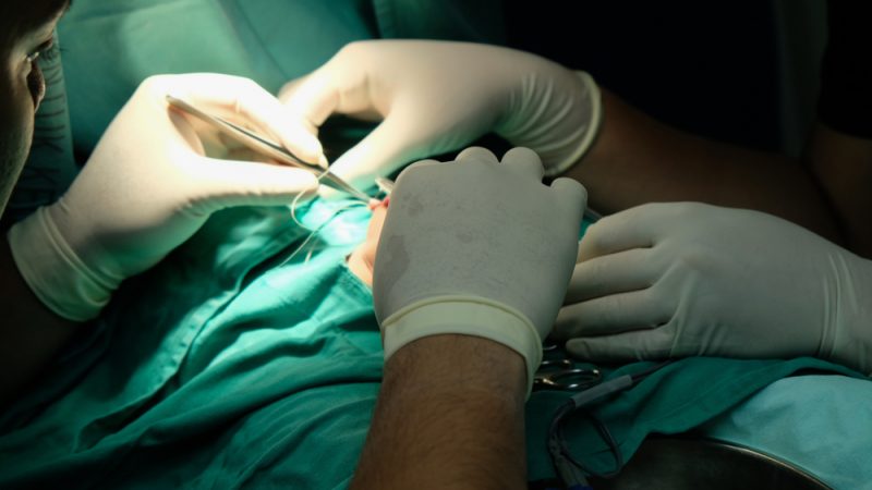 Chirurgický zákrok. Foto: Shutterstock