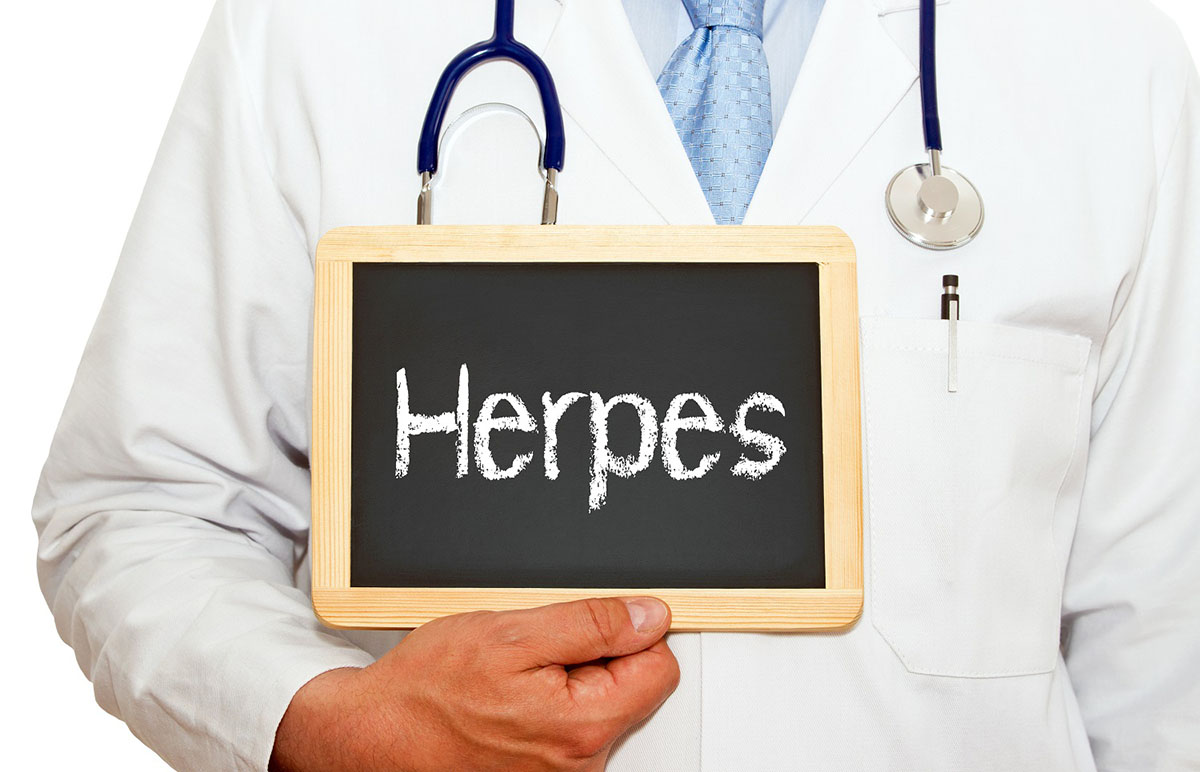 Liečba herpesu. Foto: Shutterstock