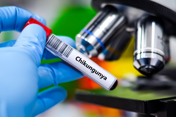 Vírus chikungunya prenáša komár tigrovaný.