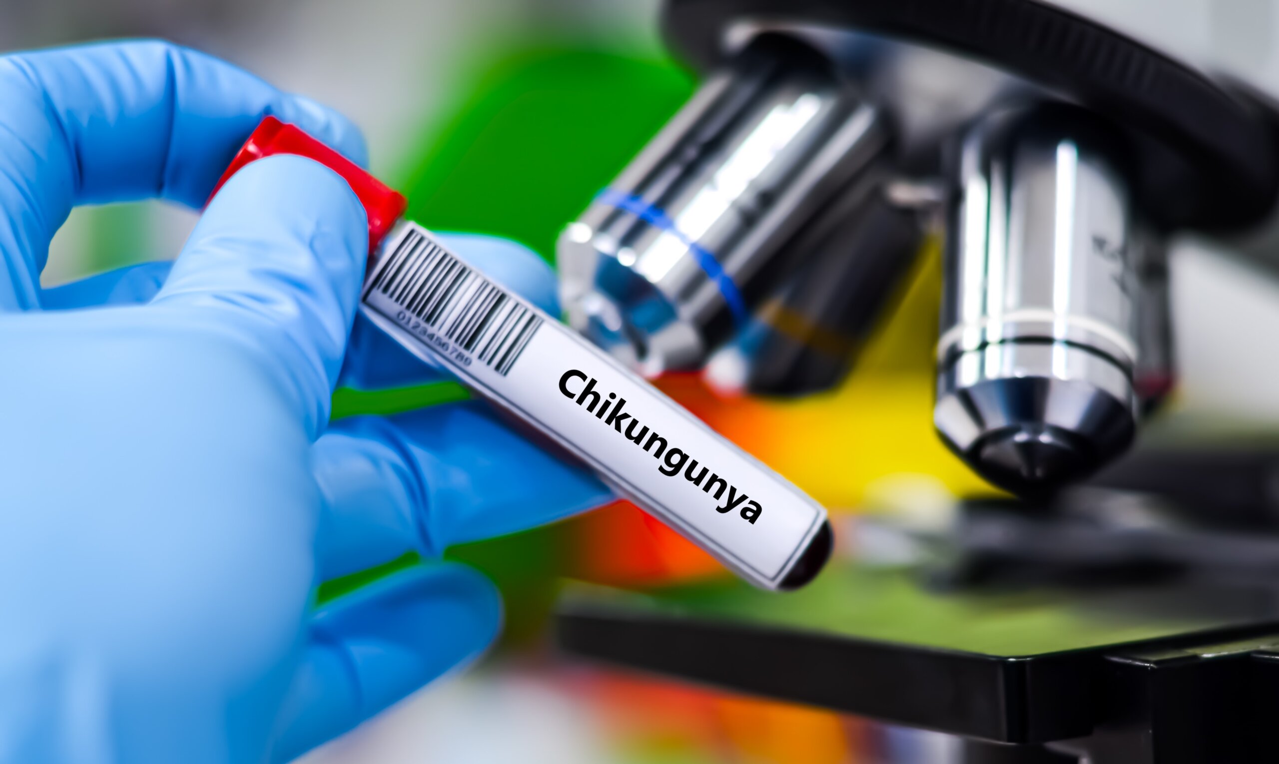 Tropická hrozba pre Európu: Vírus chikungunya sa šíri na sever