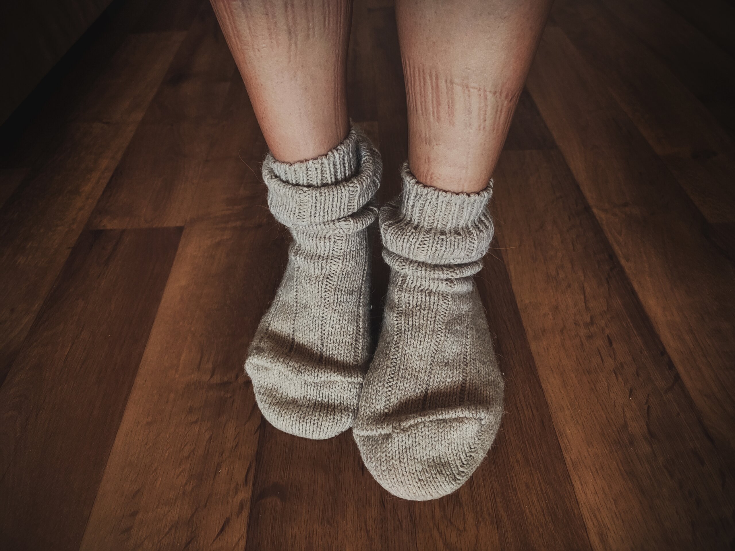 Čo to znamená, ak vás otláčajú ponožky?