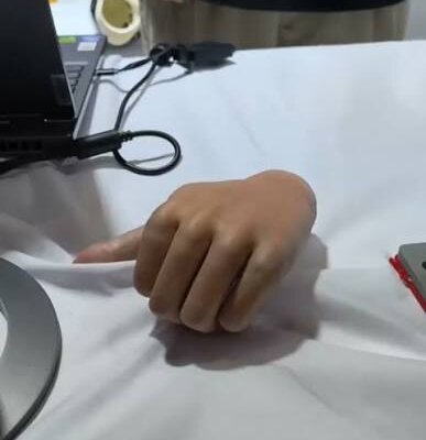 Táto bionická ruka funguje aj oddelená od tela