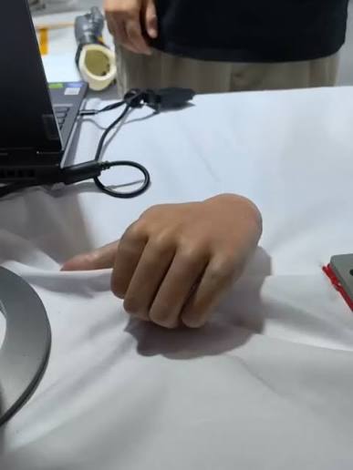 Táto bionická ruka funguje aj oddelená od tela