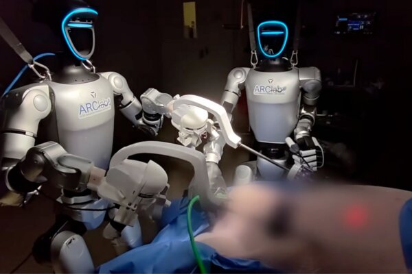 Humanoidné roboty prvýkrát operovali žlčník a odstránili ho bez chyby
